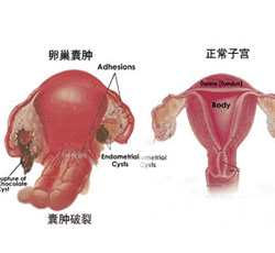 案例