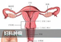 女性宫颈肿瘤的危害有什么？