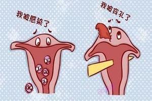 阿图什人流手术前要准备什么(正规医院打掉孩子流程)