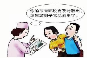 阿图什怎么取环(医院取环流程) 阿图什怎么取环(医院取环流程)