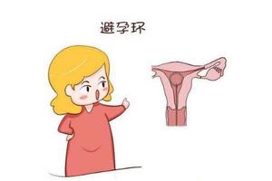 阿图什取环后月经推迟(取环了大姨妈迟迟不来)