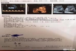 莎车20周可以引产吗(20周引产需要多少钱)