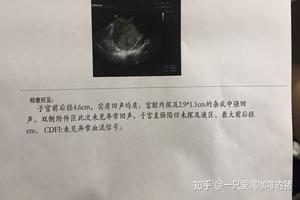 阿图什药流多久清宫(清宫几分钟能完成) 阿图什药流多久清宫(清宫几分钟能完成)