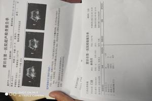 阿图什药流的医院(阿图什妇幼保健院医院) 阿图什药流的医院(阿图什妇幼保健院医院)