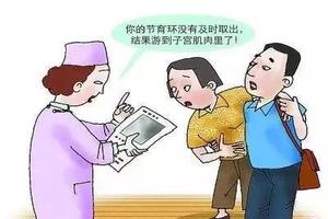 莎车取环后不怀孕(取环后为何不孕)