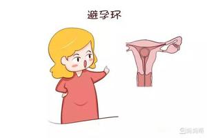 永康取环什么时候最合适(取环的最佳季节)