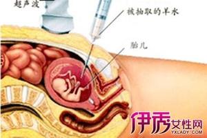 阿图什九个月引产(孕39周引产的亲身经历)