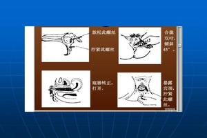 莎车女性妇科检查(莎车看妇科哪个医院好点)