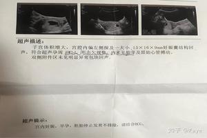 阿图什药流没反(阿图什打胎医院) 阿图什药流没反(阿图什打胎医院)