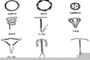 阿图什上环多久才能同环(环取了多久可以上环)