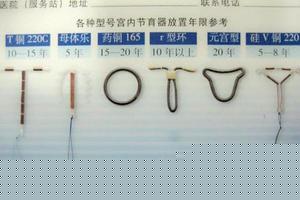 阿图什上环要做哪些检查(去上环需要做什么检查)