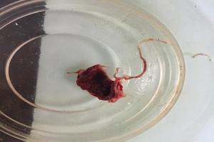 阿图什药流的(7周吃药能流掉吗) 阿图什药流的(7周吃药能流掉吗)