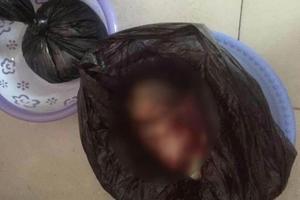 阿图什孕四个月引产(4个月引产手术详细过程) 阿图什孕四个月引产(4个月引产手术详细过程)