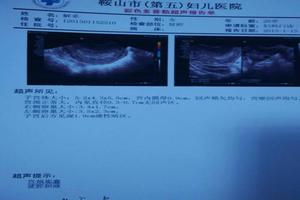 阿图什引产疼不疼(引产疼还是自然顺产疼) 阿图什引产疼不疼(引产疼还是自然顺产疼)