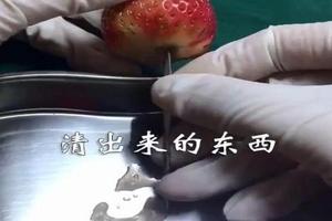 阿图什引产手术详细过程(什么是引产手术过程视频) 阿图什引产手术详细过程(什么是引产手术过程视频)