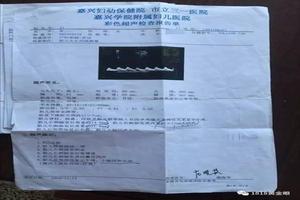 阿图什孕中期引产(孕妇引产视频) 阿图什孕中期引产(孕妇引产视频)