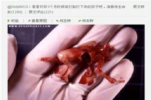 阿图什六个月引产痛吗(六个月引产疼痛几级) 阿图什六个月引产痛吗(六个月引产疼痛几级)