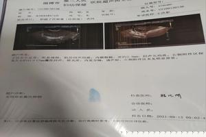 阿图什引产后调(引产后中药调理最佳时间) 阿图什引产后调(引产后中药调理最佳时间)