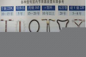 阿图什上环有几种环(杭州上环的费用大概多少)