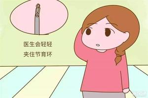 阿图什取环后注意什么(取环后第二天能上班吗)