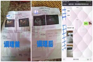 阿图什妇科囊肿(阿图什市妇科医院)
