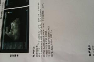 阿图什引产后腰疼(引产后腰疼怎么回事) 阿图什引产后腰疼(引产后腰疼怎么回事)