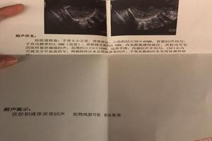阿图什引产后需要复查吗(引产后需要复查什么项目) 阿图什引产后需要复查吗(引产后需要复查什么项目)