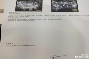 阿图什药流复查(阿图什药流只到克孜勒苏柯尔克孜自治州华山领先) 阿图什药流复查(阿图什药流只到克孜勒苏柯尔克孜自治州华山领先)