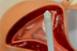 莎车取环疼不疼(莎车五金城铜环)